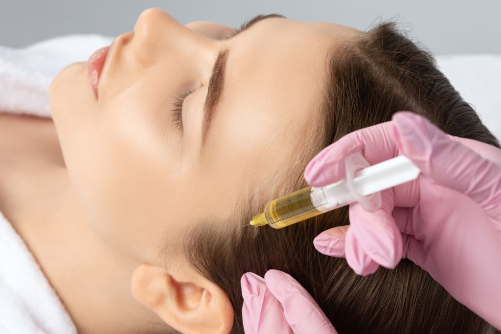 prp therapy for hair loss